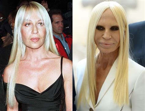 donatella versace antes|donatella versace without plastic surgery.